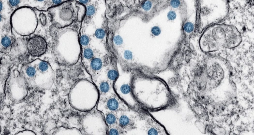 Coronavirus covid